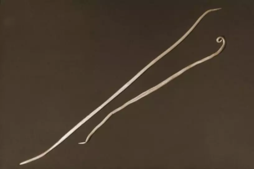 A close-up image of roundworms